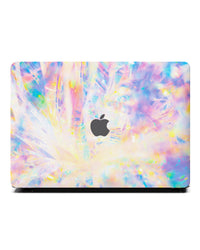 Macbook 保護套 - 虹彩金屬