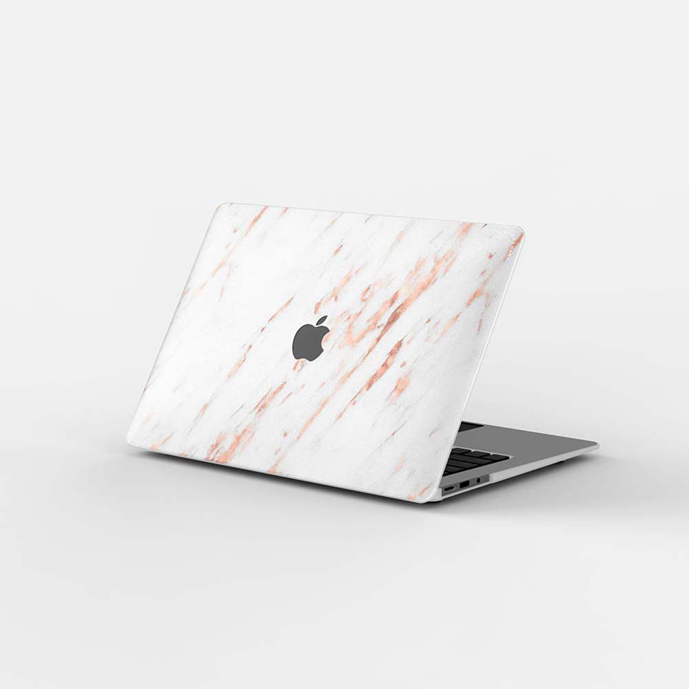 Macbook Case Set - Protective Rose Gold Glitter