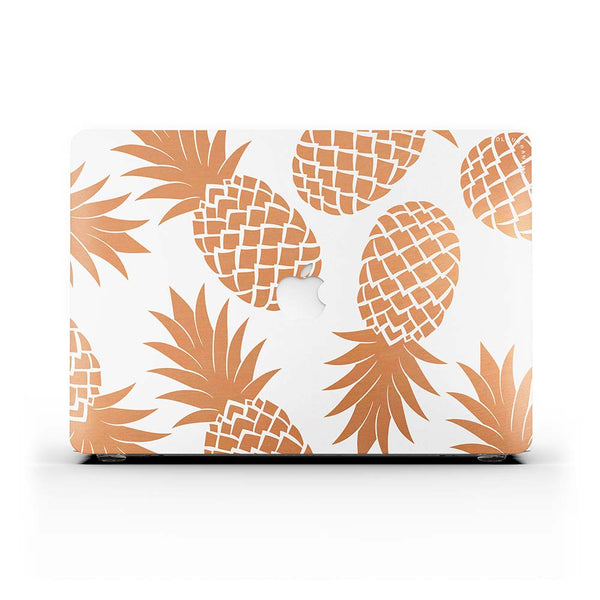 Macbook Case-Rose Gold Pineapple