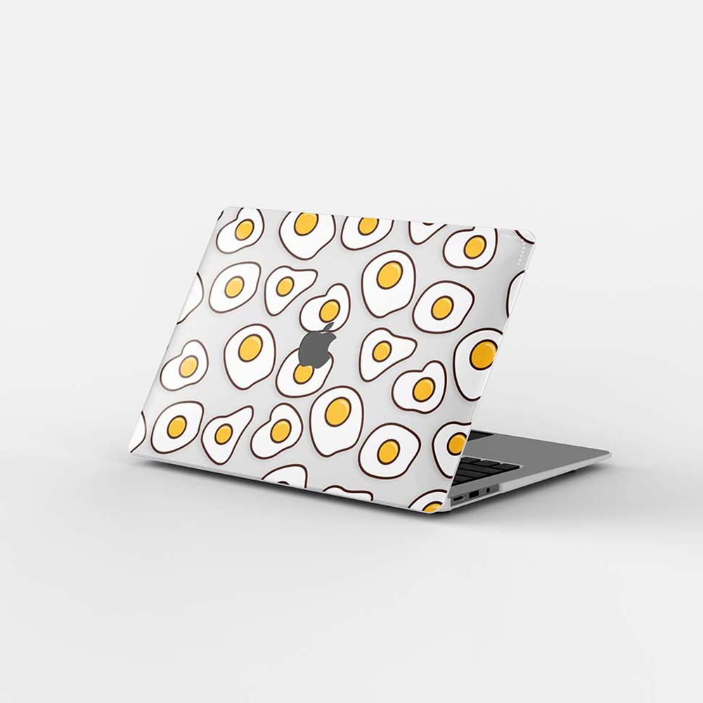 Macbook Case-Fried Egg
