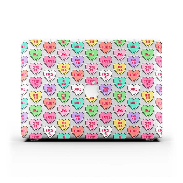 Macbook Case-Sweethearts