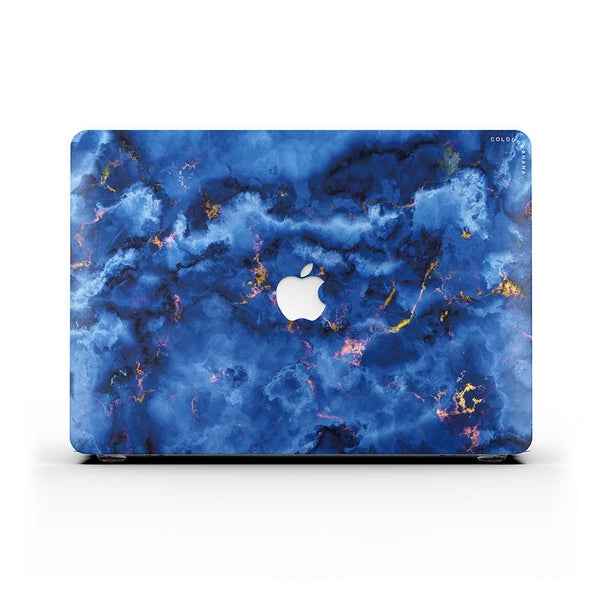 Macbook Case-Bright Vivid Blue