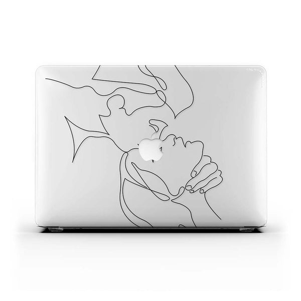 Macbook Case - Forehead Kiss